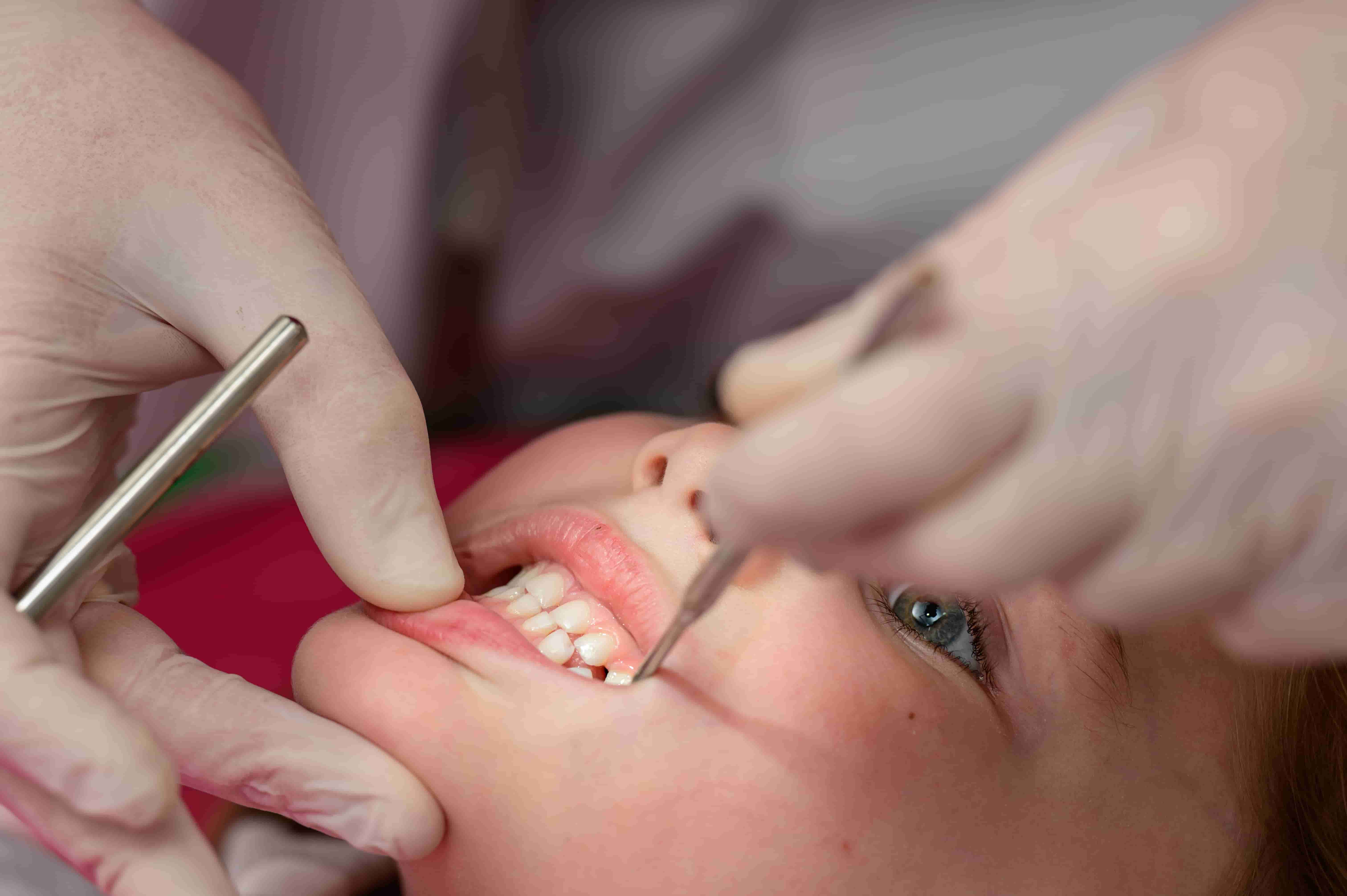 Pediatric Dentistry